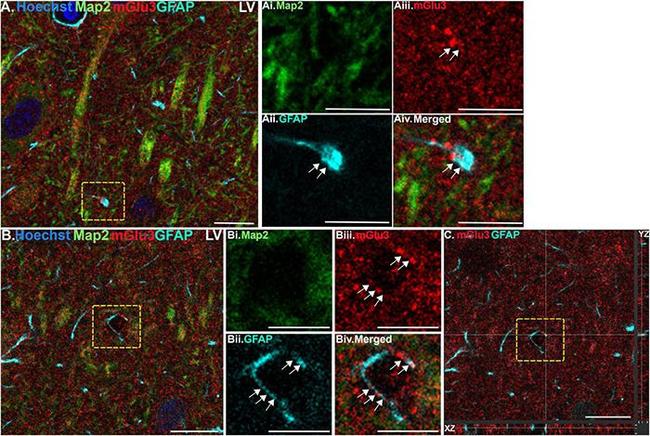 Mouse IgG (H+L) Highly Cross-Adsorbed Secondary Antibody in Immunohistochemistry (IHC)