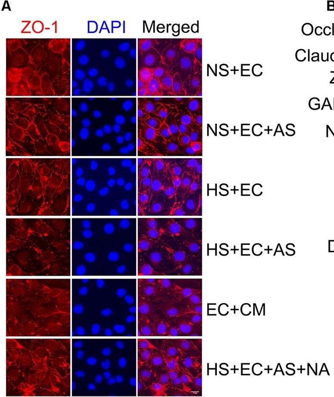 Rabbit IgG (H+L) Highly Cross-Adsorbed Secondary Antibody in Immunohistochemistry (Frozen) (IHC (F))