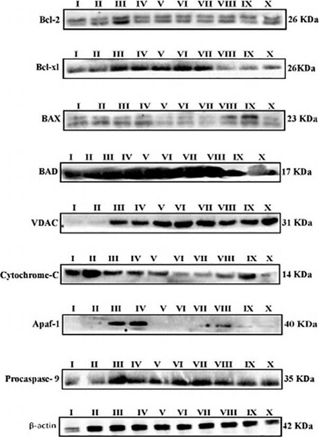 Mouse IgG (H+L) Secondary Antibody in Western Blot (WB)