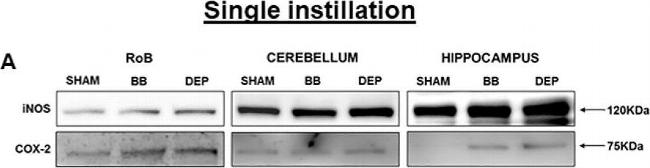 Rabbit IgG (H+L) Secondary Antibody in Western Blot (WB)