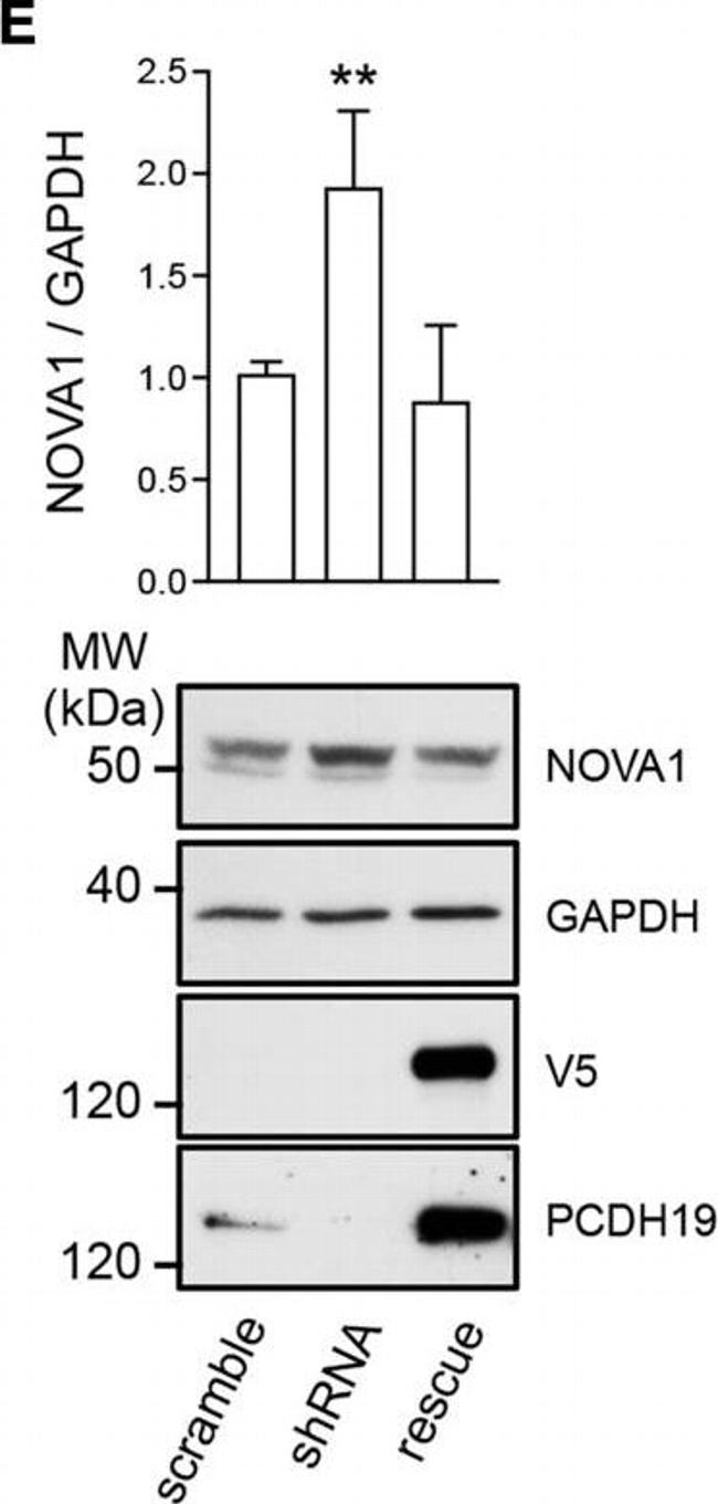 Rabbit IgG (H+L) Secondary Antibody in Western Blot (WB)