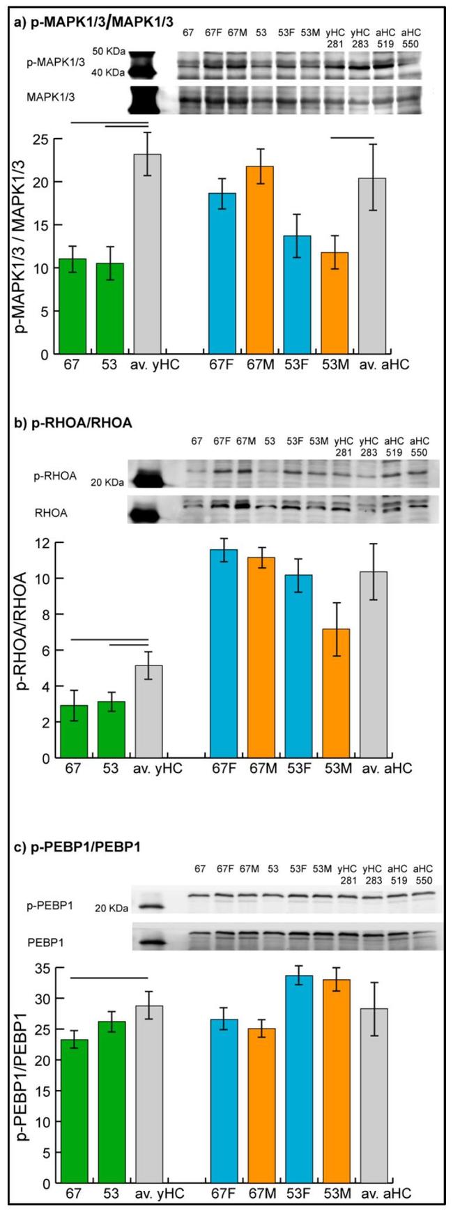 Phospho-ERK1/ERK2 (Thr202, Tyr204) Antibody in Western Blot (WB)