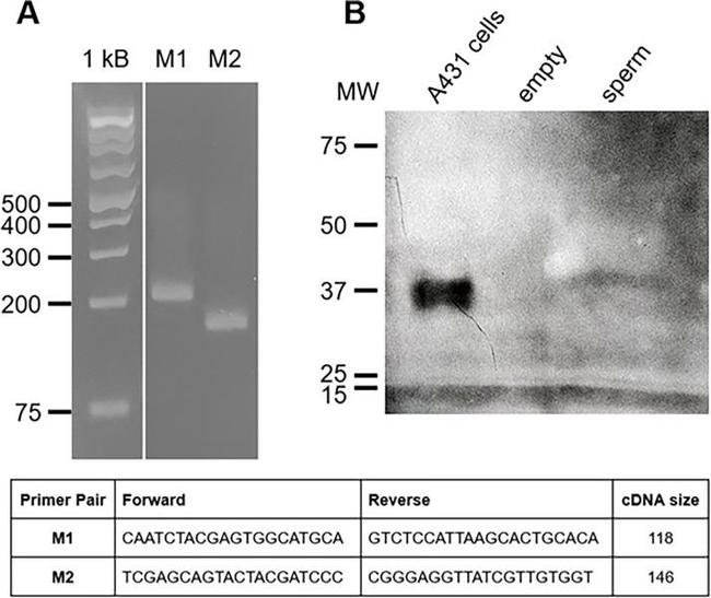 ERK1/ERK2 Antibody in Western Blot (WB)