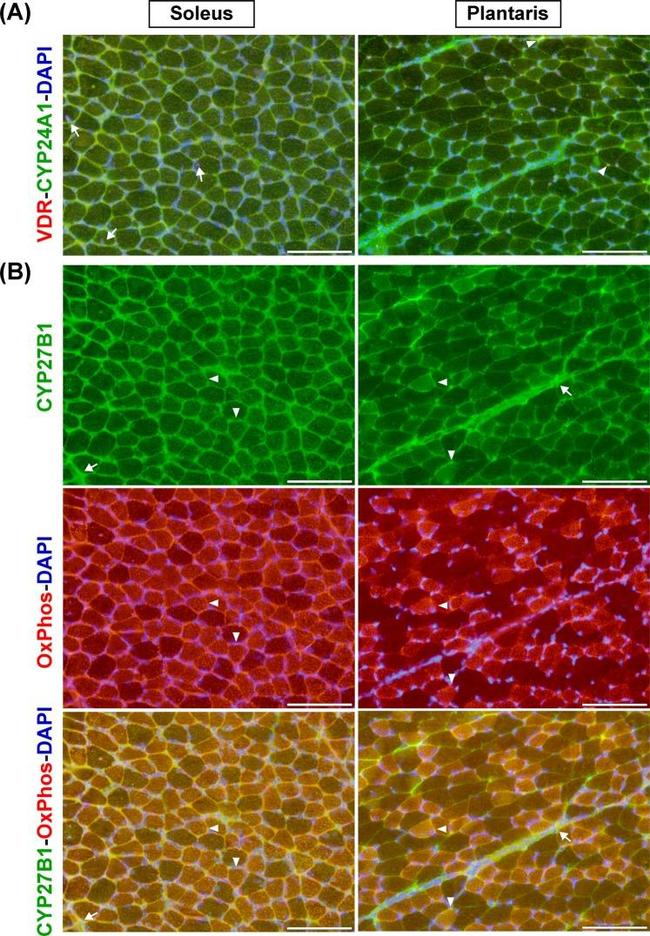 ATP5A1 Antibody in Immunohistochemistry (IHC)