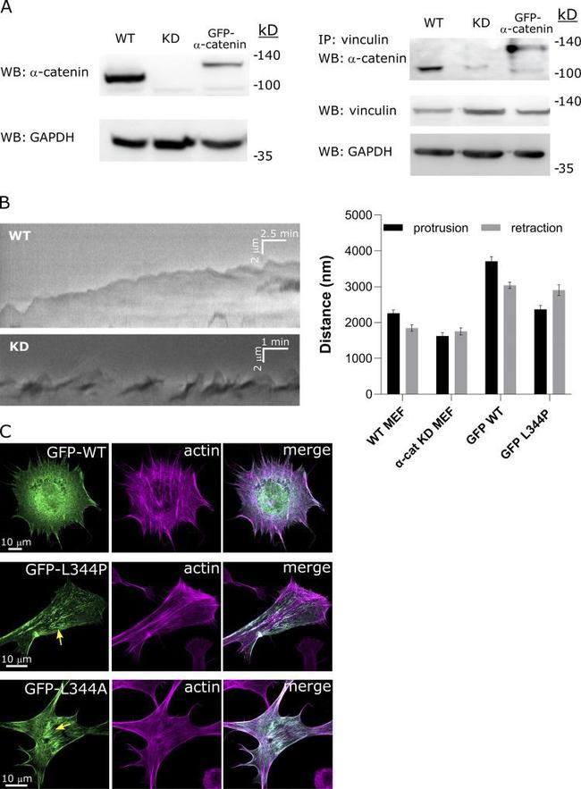 Vinculin Antibody in Immunoprecipitation (IP)