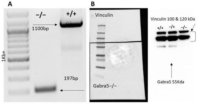 Vinculin Antibody in Western Blot (WB)