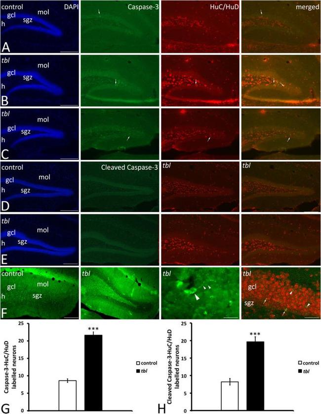 Caspase 3 Antibody in Immunohistochemistry (IHC)