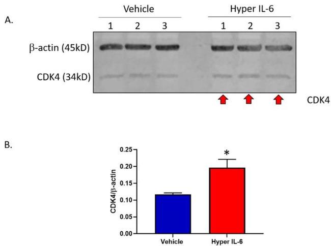 CDK4 Antibody in Western Blot (WB)