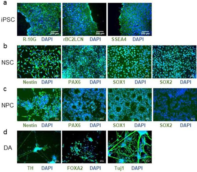 Nestin Antibody in Immunocytochemistry (ICC/IF)