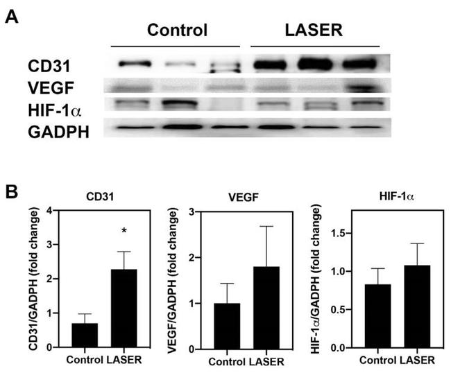 HIF1A Antibody in Western Blot (WB)