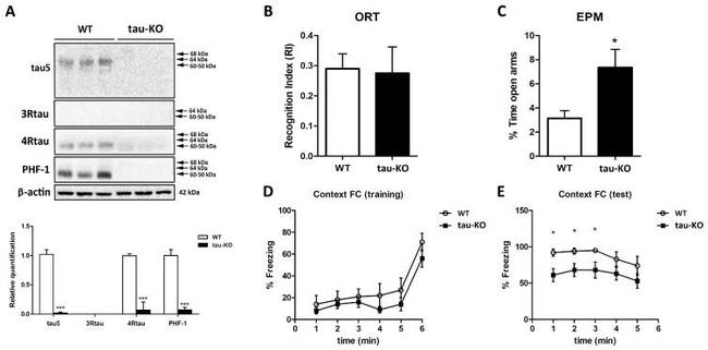 Tau Antibody in Western Blot (WB)