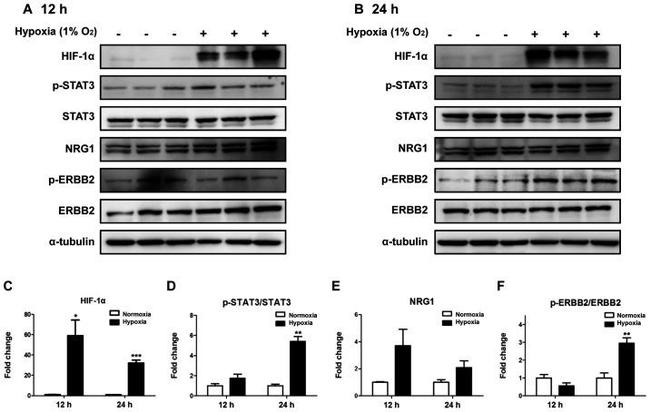 ErbB2 (HER-2) Antibody in Western Blot (WB)