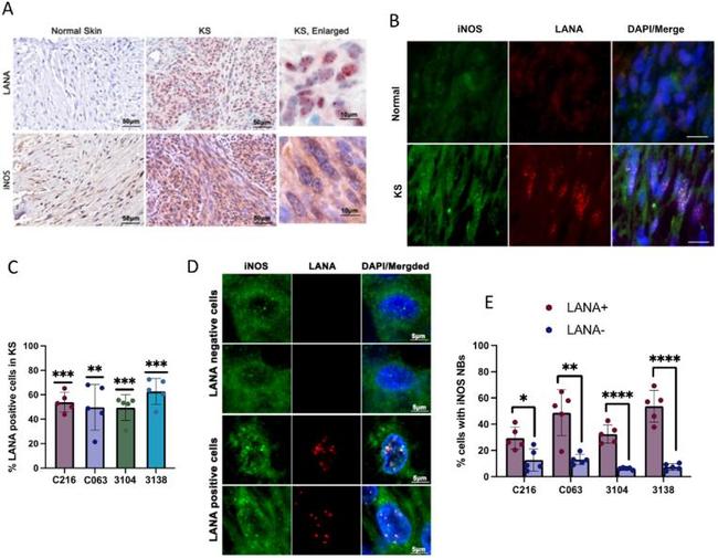 iNOS Antibody in Immunohistochemistry (IHC)