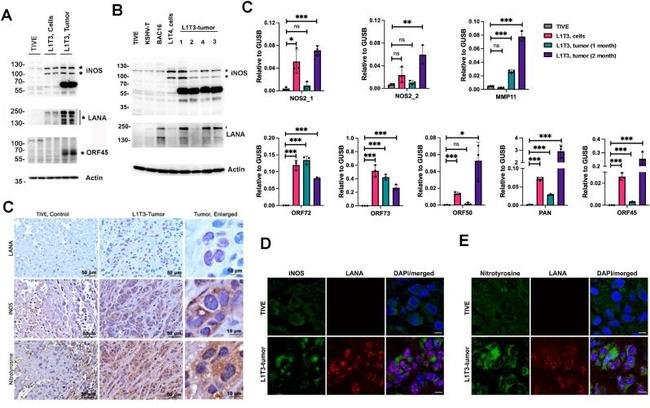 iNOS Antibody in Immunohistochemistry (IHC)