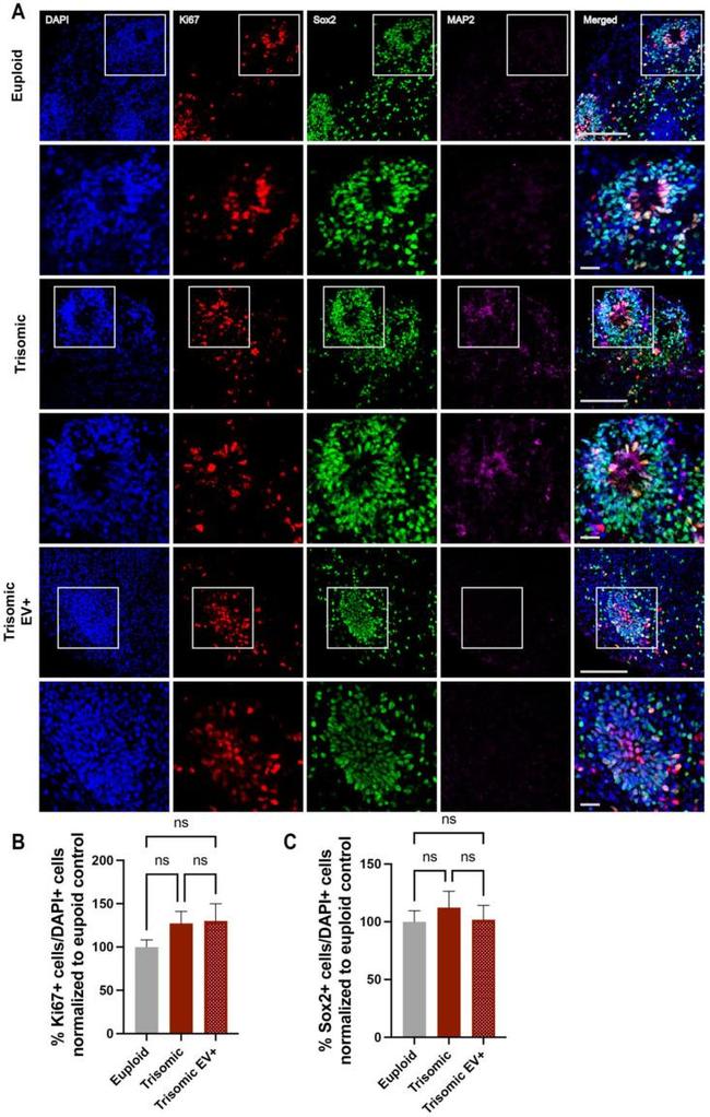 MAP2 Antibody in Immunohistochemistry (IHC)