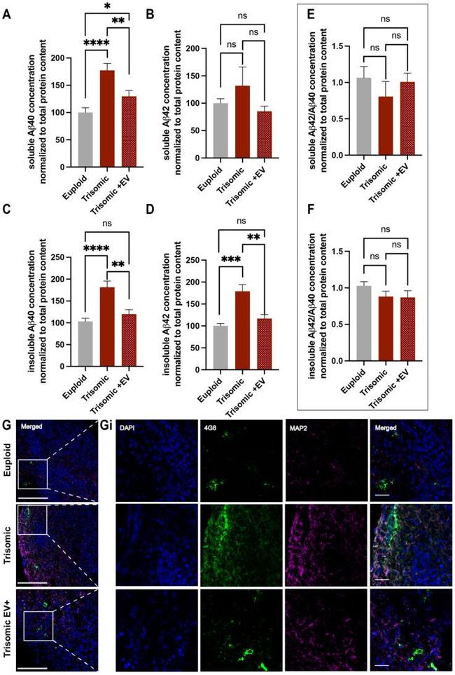 MAP2 Antibody in Immunohistochemistry (IHC)