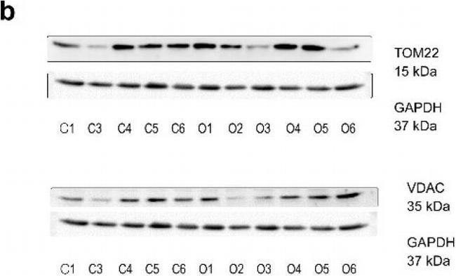 Mouse IgG (H+L) Secondary Antibody in Western Blot (WB)