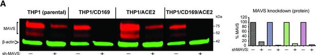 Rabbit IgG (H+L) Secondary Antibody in Western Blot (WB)