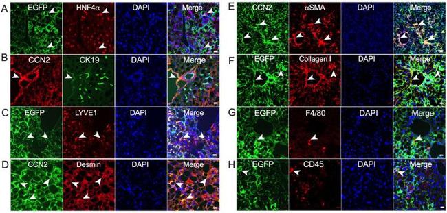 Desmin Antibody in Immunohistochemistry (IHC)