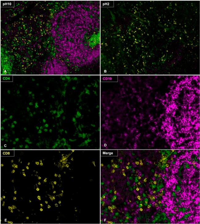 CD4 Antibody in Immunohistochemistry (Paraffin) (IHC (P))