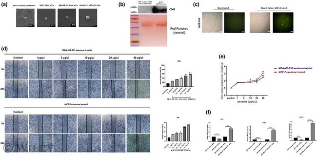 CD63 Antibody in Western Blot (WB)