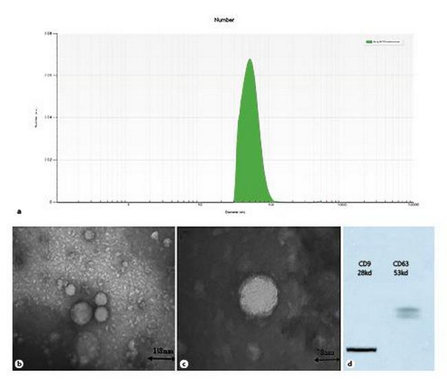 CD63 Antibody in Western Blot (WB)