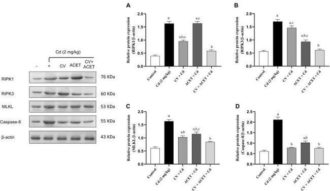 RIP1 Antibody in Western Blot (WB)