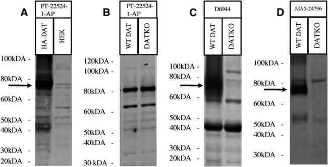 Dopamine Transporter Antibody in Western Blot (WB)