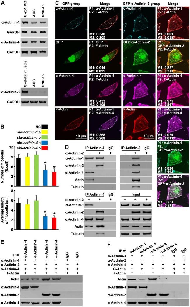 alpha Actinin 4 Antibody in Western Blot, Immunoprecipitation (WB, IP)