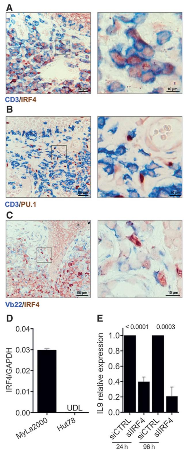 IRF4 Antibody in Immunohistochemistry (IHC)