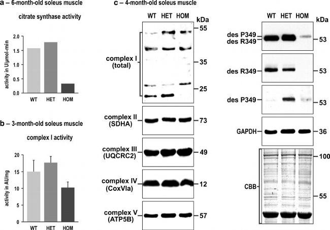 ATP5A1 Antibody in Western Blot (WB)