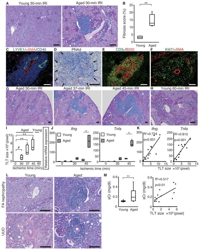 Ki-67 Antibody in Immunohistochemistry (Paraffin) (IHC (P))