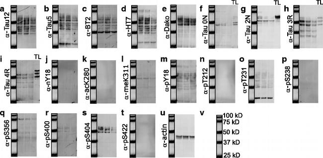 Phospho-Tau (Ser404) Antibody in Western Blot (WB)