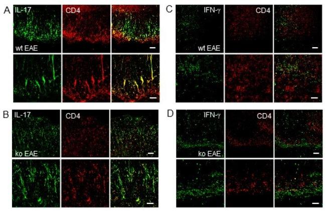 IL-17A Antibody in Immunohistochemistry (IHC)