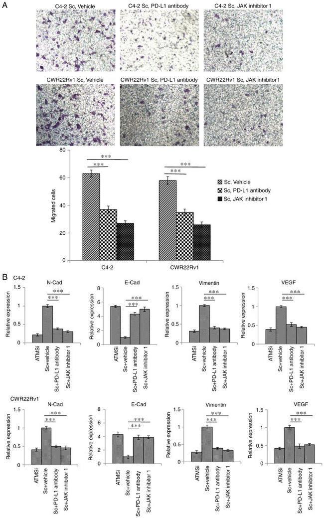 CD274 (PD-L1, B7-H1) Antibody in Immunohistochemistry (IHC)