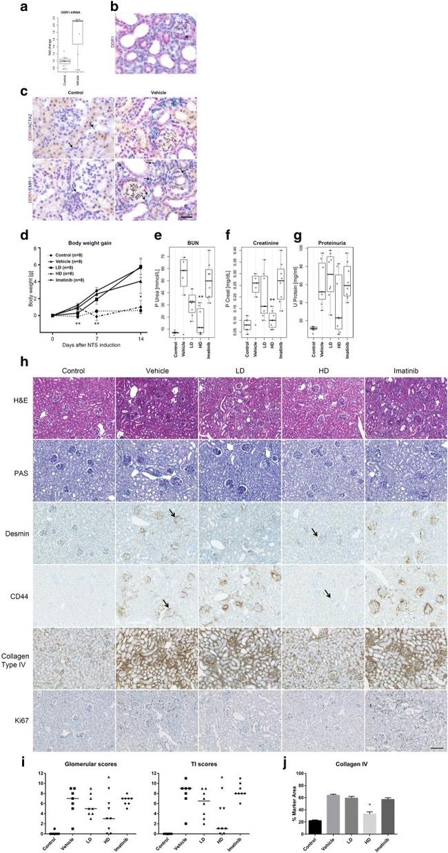 Ki-67 Antibody in Immunohistochemistry, Immunohistochemistry (Paraffin) (IHC, IHC (P))