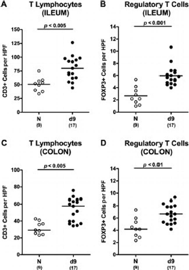 FOXP3 Antibody in Immunohistochemistry (IHC)