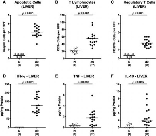 FOXP3 Antibody in Immunohistochemistry (IHC)