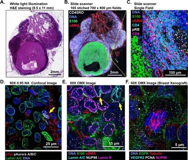 Alpha-Smooth Muscle Actin Antibody in Immunohistochemistry (IHC)