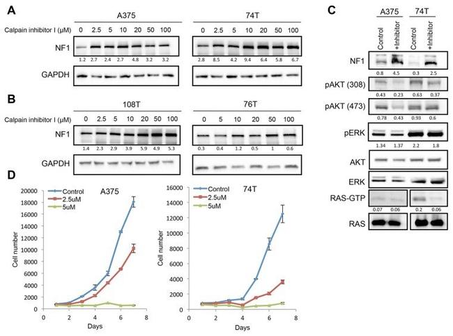 ERK1/ERK2 Antibody in Western Blot (WB)