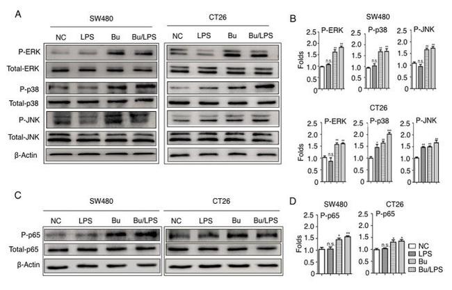 Phospho-ERK1/2 (Thr202, Tyr204) Antibody in Western Blot (WB)