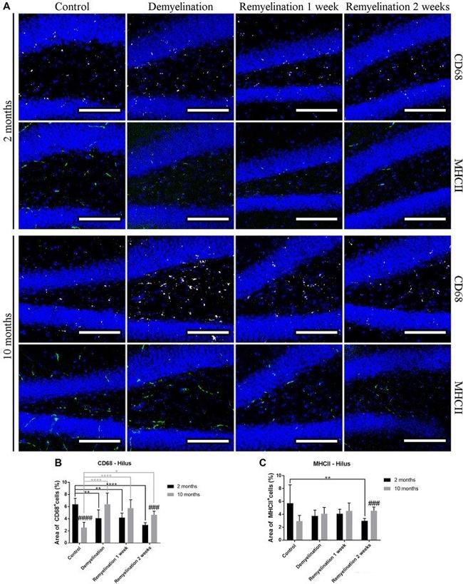 MHC Class II (I-A/I-E) Antibody in Immunohistochemistry (IHC)