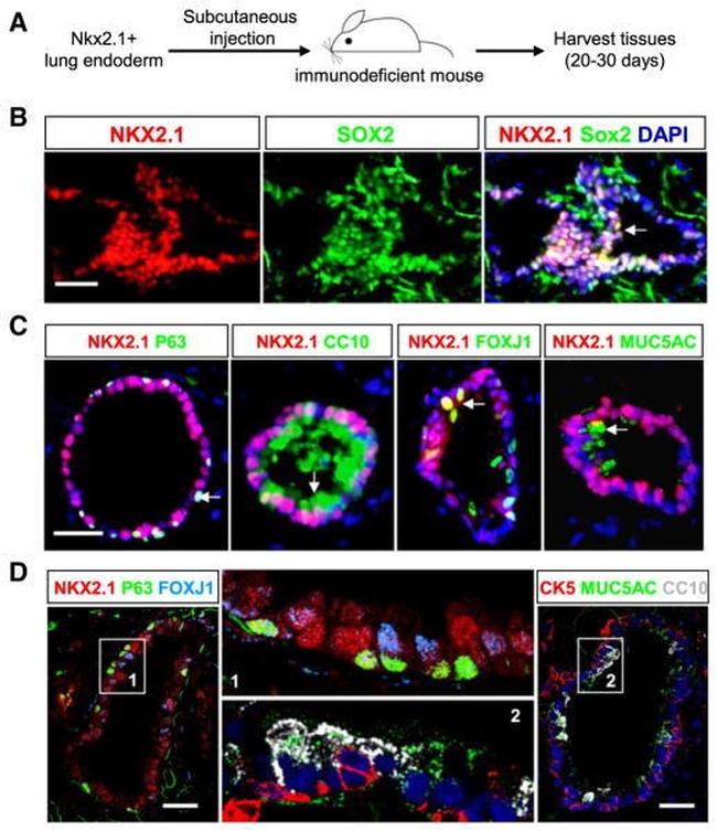 FOXJ1 Antibody in Immunohistochemistry (IHC)