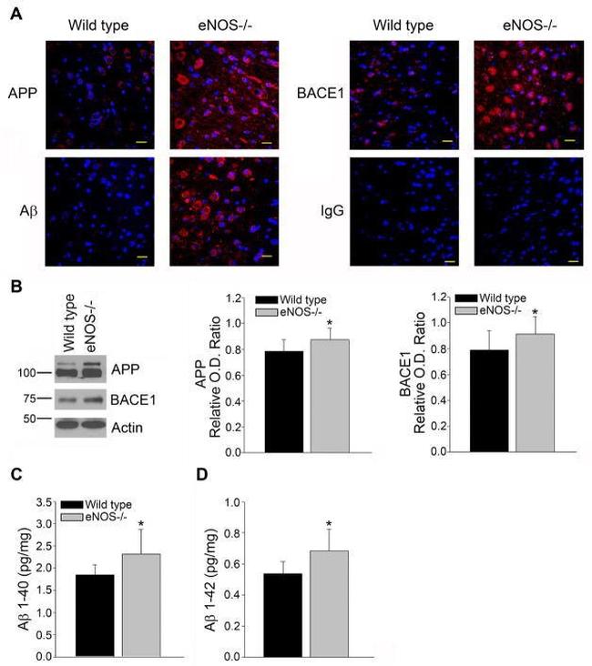 beta Amyloid Antibody in Immunohistochemistry (IHC)