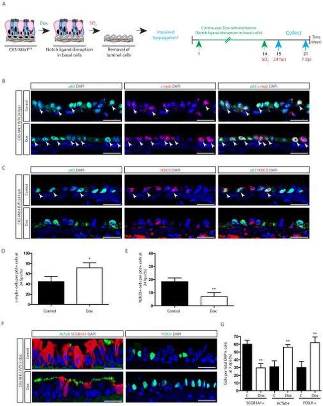 FOXJ1 Antibody in Immunohistochemistry (IHC)