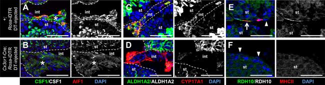 MHC Class II (I-A/I-E) Antibody in Immunohistochemistry (IHC)