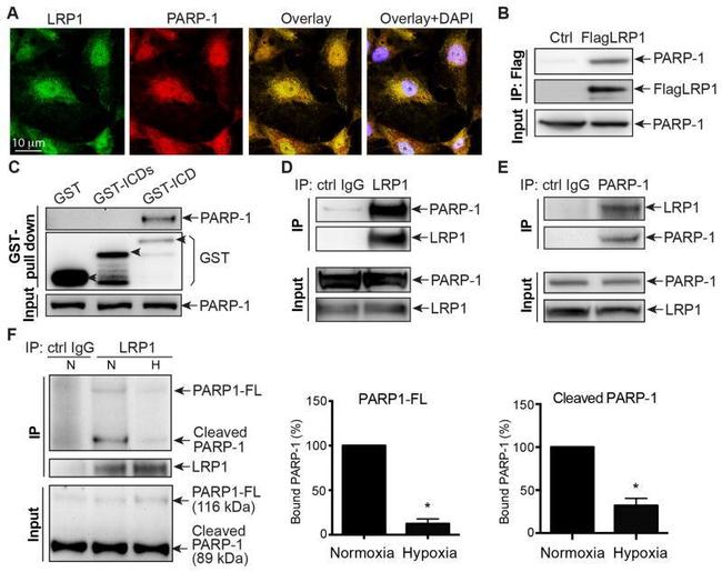 PARP1 Antibody in Immunocytochemistry (ICC/IF)