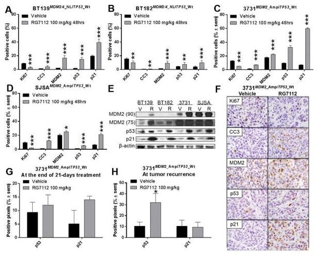 p53 Antibody in Immunohistochemistry (IHC)