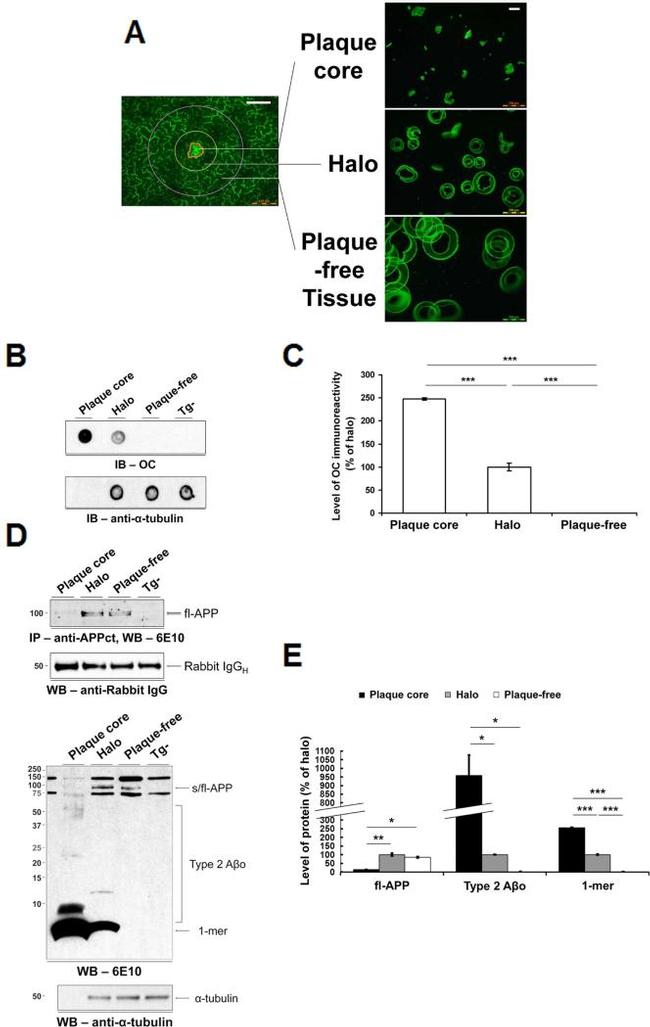 beta Amyloid Antibody in Immunoprecipitation (IP)