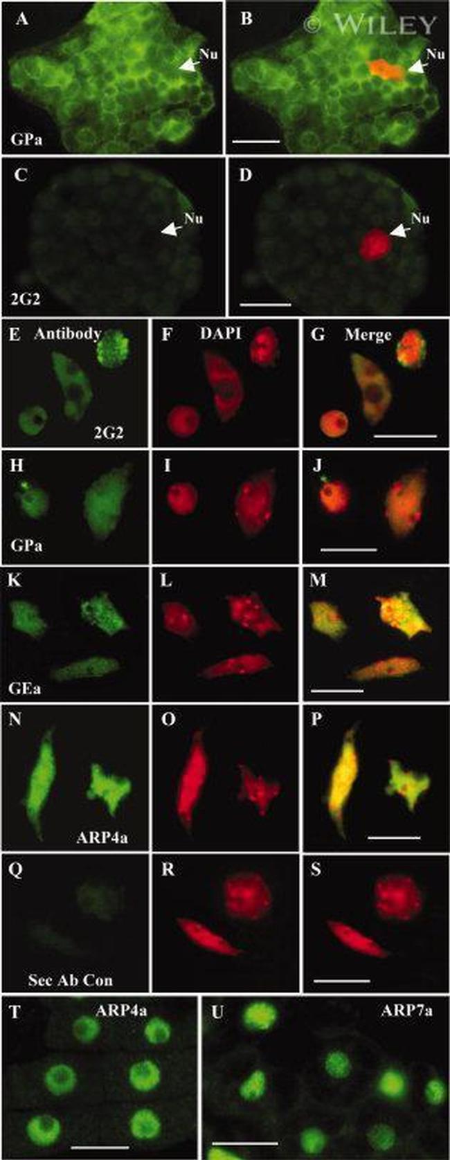 Actin Antibody in Immunocytochemistry (ICC/IF)